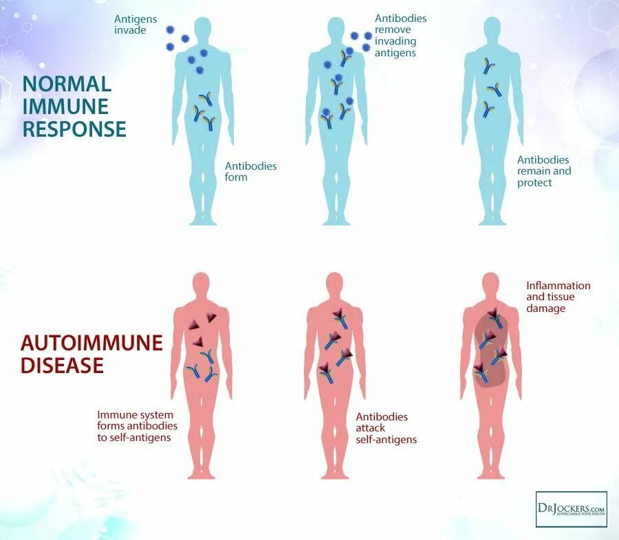Autoimmune disease. Аутоиммунные заболевания иллюстрации. Autoimmune disease. Autoimmune disease. Autoimmune disease.