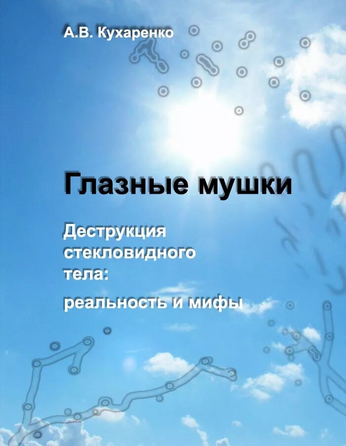 Плавающие мушки перед глазами. Плавающие помутнения в глазах. Мушки перед глазами лекарства. Лечение у женщин мушек перед глазами. Плавающие мушки перед глазами.