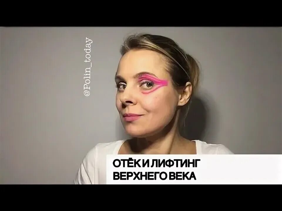 Нависшее веко тейпирование нависшего века. Тепы от нависшего века. тейпирование лица для нависшего века.