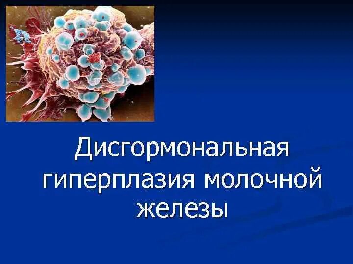 Дисгормональные гиперплазии молочной железы. Злокачественная опухоль молочной железы. Диффузная дисгормональная гиперплазия молочных желез. Дисгормональная железистая гиперплазия. Злокачественная опухоль лечится