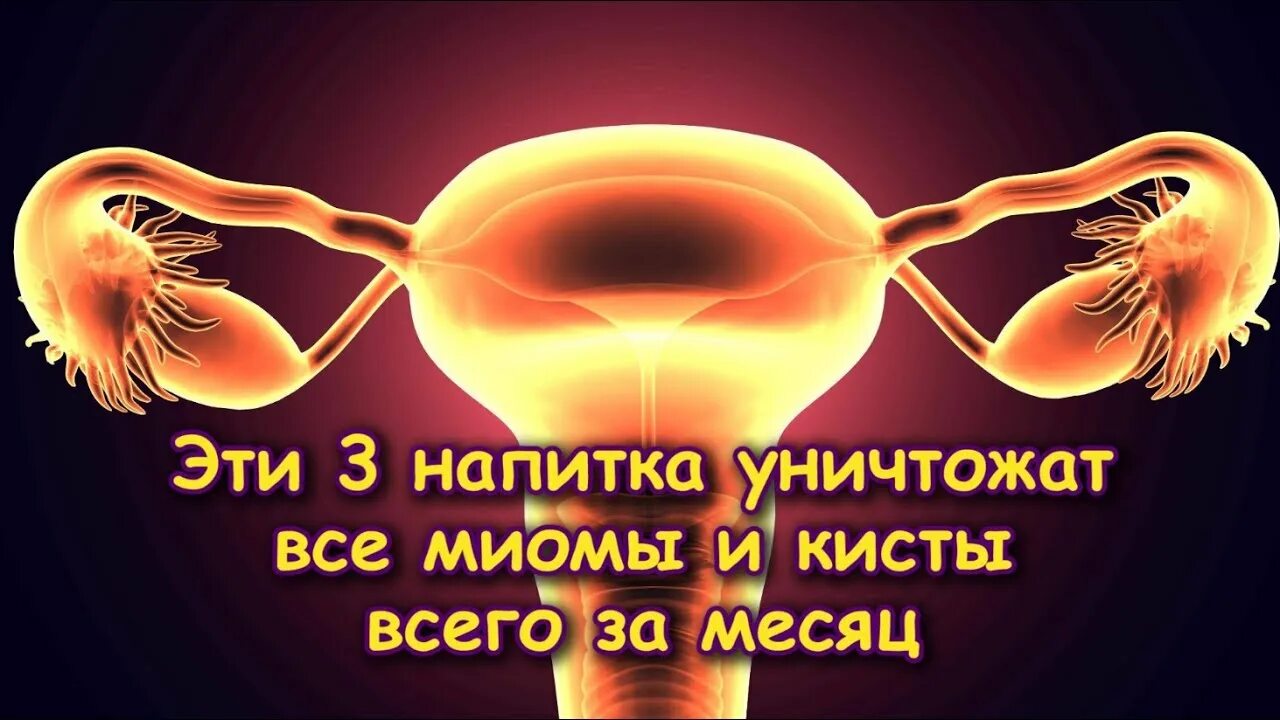 Лечим кисту яичника народными. Заговор от кисты яичника. Молитва заговор от кисты яичника.