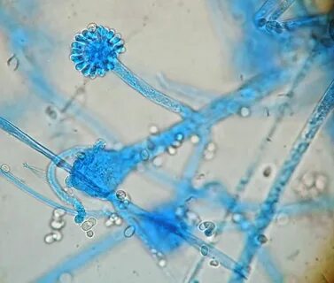 Mucor