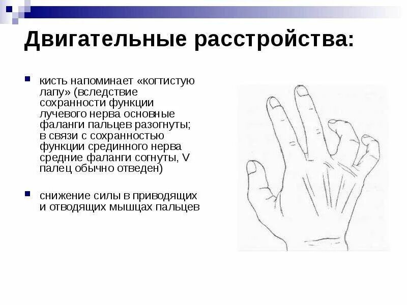 Неврит локтевого нерва когтистая лапа. Вид кисти при поражении локтевого нерва. Положение кисти при повреждении лучевого нерва. Невропатия локтевого и срединного нерва.