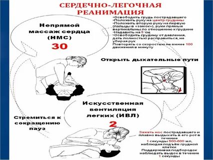 Ситуацию с рекомендуемым временем для начала реанимации