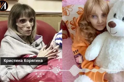 Ребенок в год 17 кг