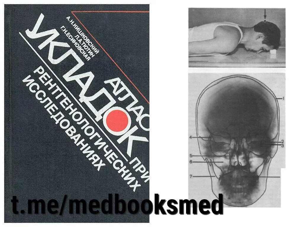 Атлас укладок при рентгенологических исследованиях. Укладки при рентгенологических исследованиях кишковский. Укладки при рентгенологических исследованиях. Укладки при рентгенологических исследованиях кишковский. Меллер атлас рентгенологических укладок.