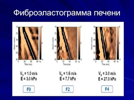 Фиброэластометрия печени кемерово