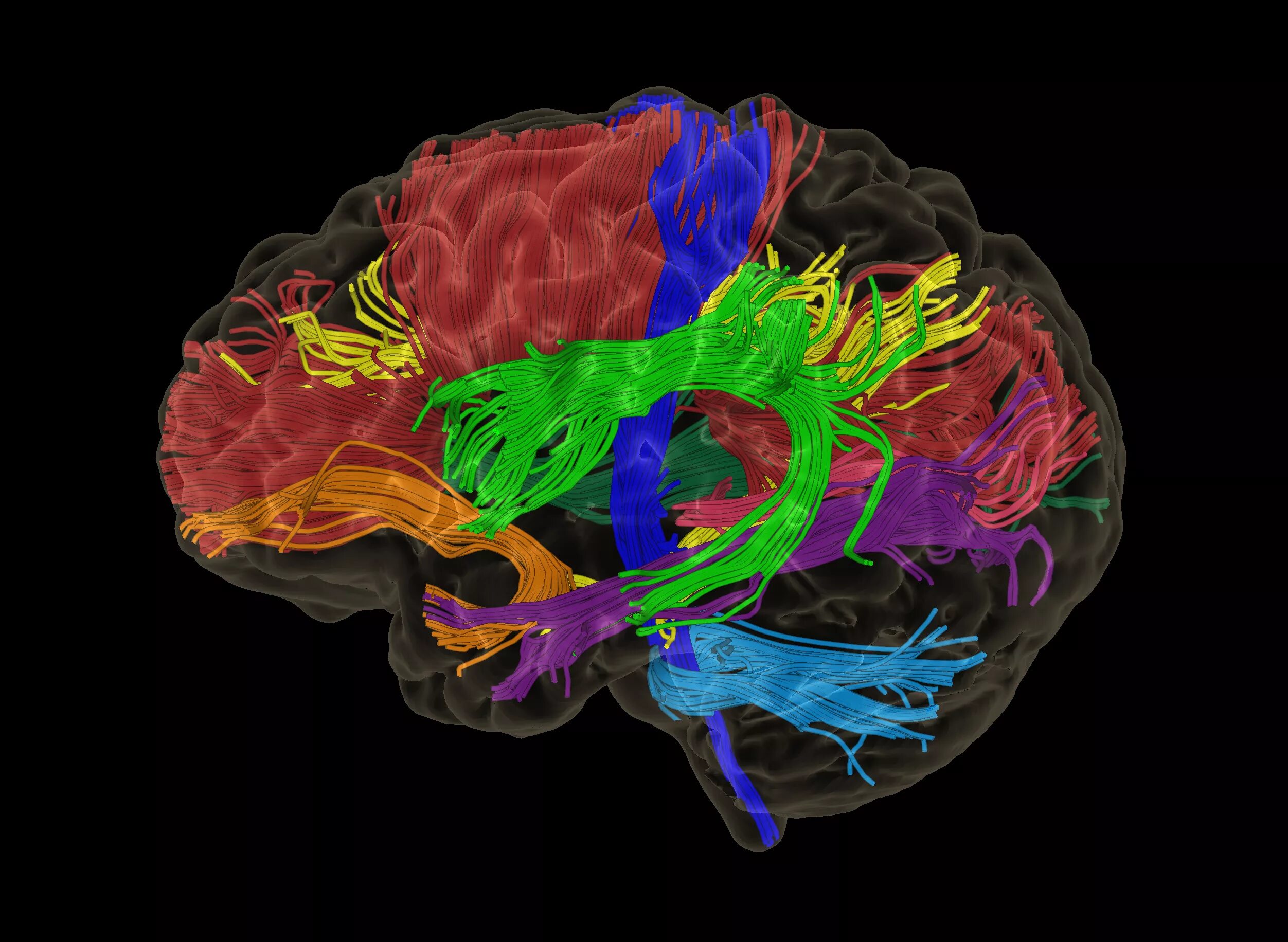 Colored brains