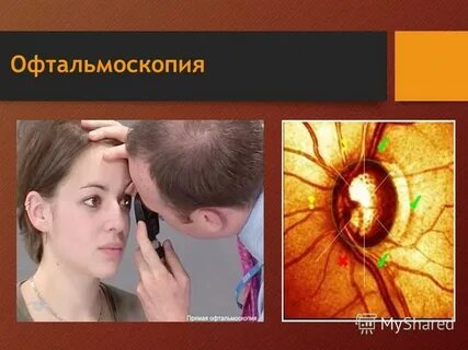 Офтальмоскопия это