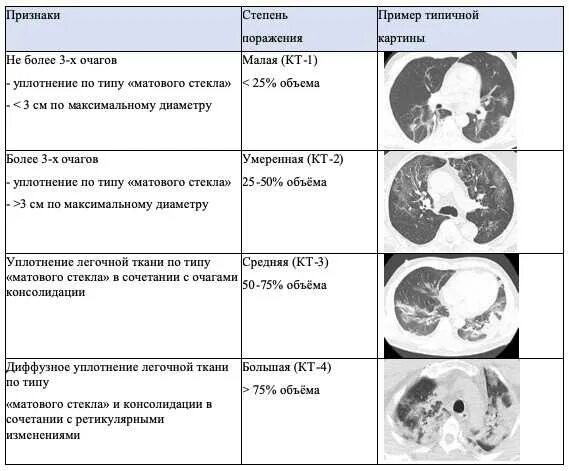 Кт 4 легкие. Поражение легких при кт коронавирус. Степени поражения легких при коронавирусе по кт. Степени ковид на кт. Степени пневмонии на кт.