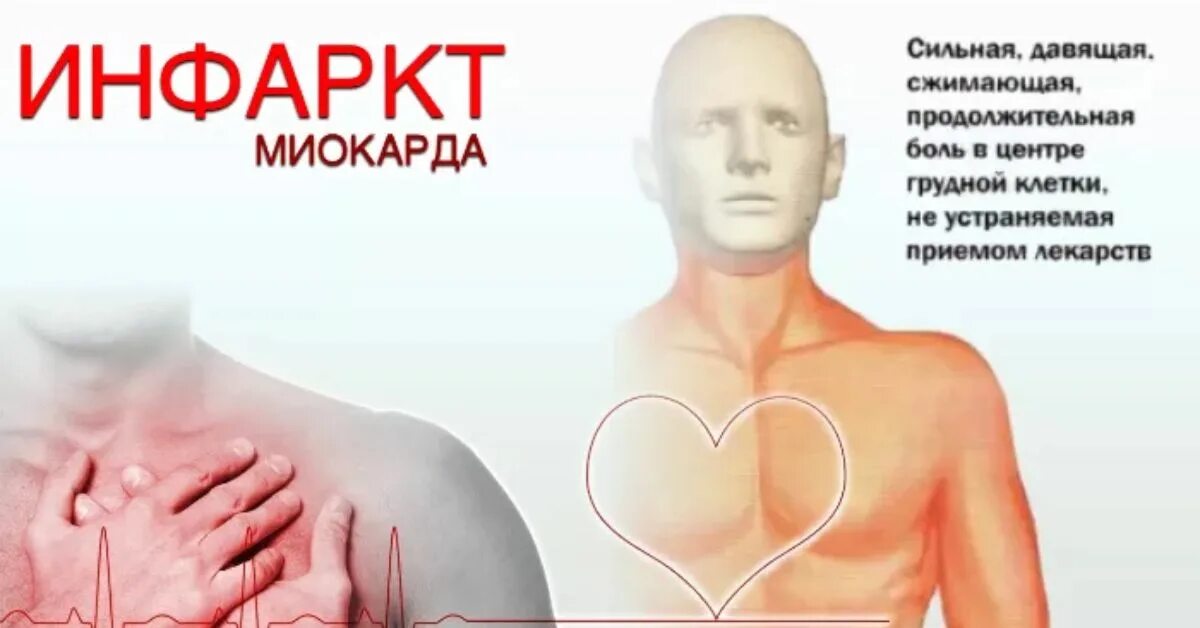 Инфаркт миокарда 2025. Инфаркт миокарда симптомы. сердце инфаркт миокарда симптомы. профилактика инфаркта у мужчин. симптомы при инфаркте миокарда у мужчин.