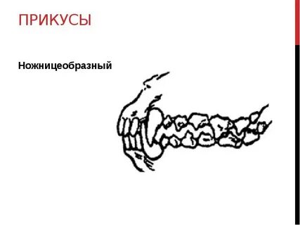 Схемы прикусов