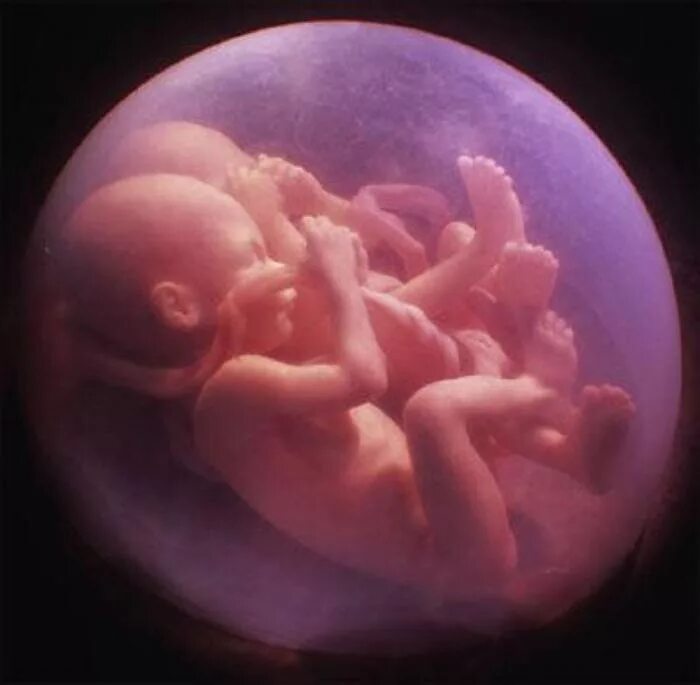 Притча про младенцев в утробе. Эмбрион многоплодная беременность. Многоплодная беременность Близнецы в утробе. Младенец в утробе матери.
