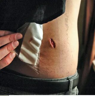 Stockport 'good Samaritan' left with deep wound 