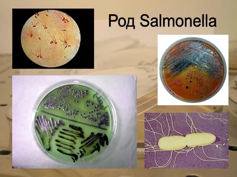 Выявление бактерий рода salmonella. Бактерии рода сальмонелла. сальмонелла микробиология этиология. метод выявления бактерий рода salmonella. сальмонеллы роды бактерий.