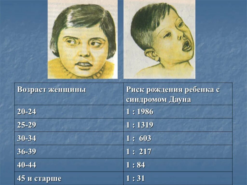 Вероятность рождения дауна. Синдром Дауна вероятность. Вероятность рождения с синдромом Дауна. Риск рождения Дауна. Риски рождения ребенка с синдромом Дауна.