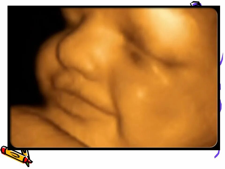 Ребенок плачет в утробе. 3д УЗИ на 24 неделе беременности. 23 Неделя беременности 3д УЗИ. Фото плода 24 недели беременности на УЗИ. Эмбрион 24 недели беременности.