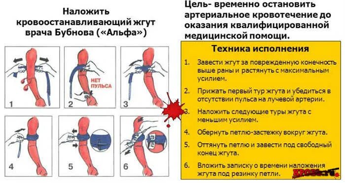 Сколько держать артериальный жгут. Жгут кровоостанавливающий Альфа. Жгут Альфа алгоритм. Правила наложения жгута Альфа. Жгут кровоостанавливающий для артериального кровотечения.