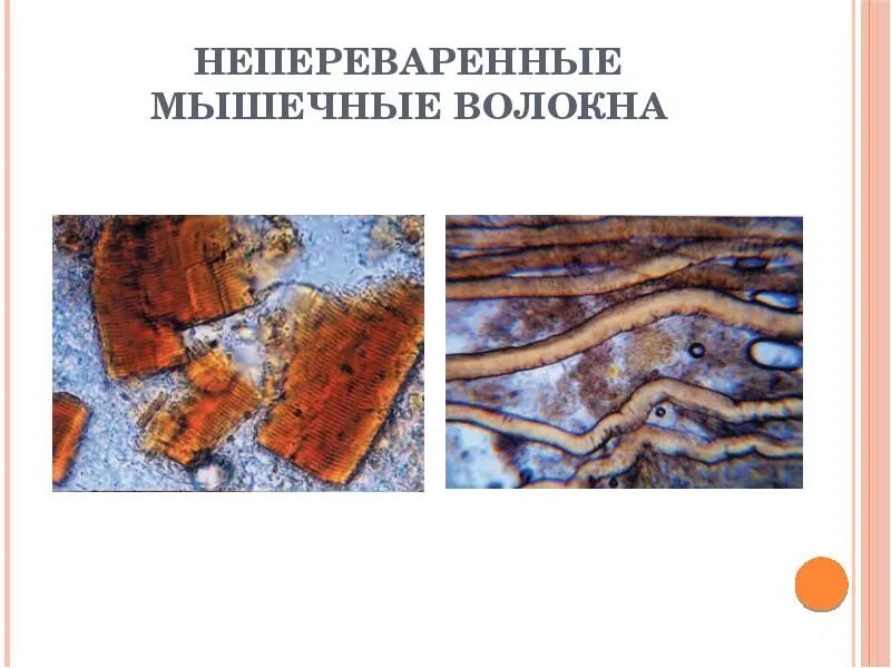 Копрограмма мышечные волокна без исчерченности. Препарат сердечная мышечная ткань железный гематоксилин. Поперечно полосатое мышечное волокно. Соединительная ткань в кале микроскопия. Мышечное волокно миосимпласт.