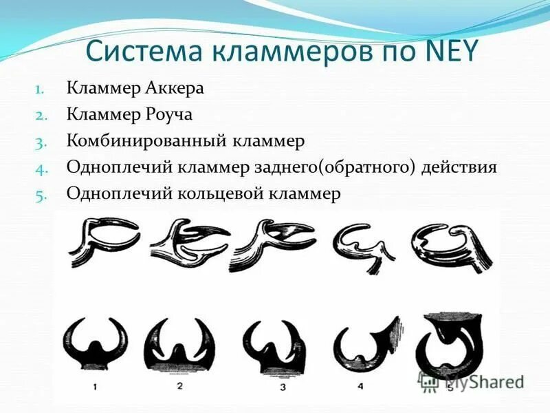 Классификация кламмеров. 3 тип системы нея. Система кламмеров ney. Опорно удерживающий кламмер аккера. Классификация каммеров ноя.