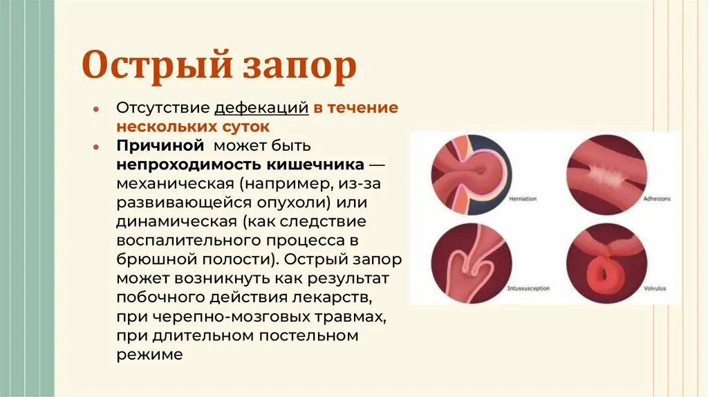 Острый запор у взрослого. Причины острого запора. Почему появляется запор