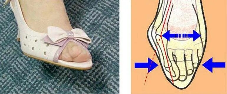 Нога имеет плоскую ползательную подошву