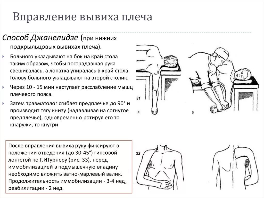 Вправление плеча по методу Джанелидзе. Метод Джанелидзе вправление вывиха. Вправление вывиха плеча Джанелидзе. Вправление вывиха плеча методом Джанелидзе.