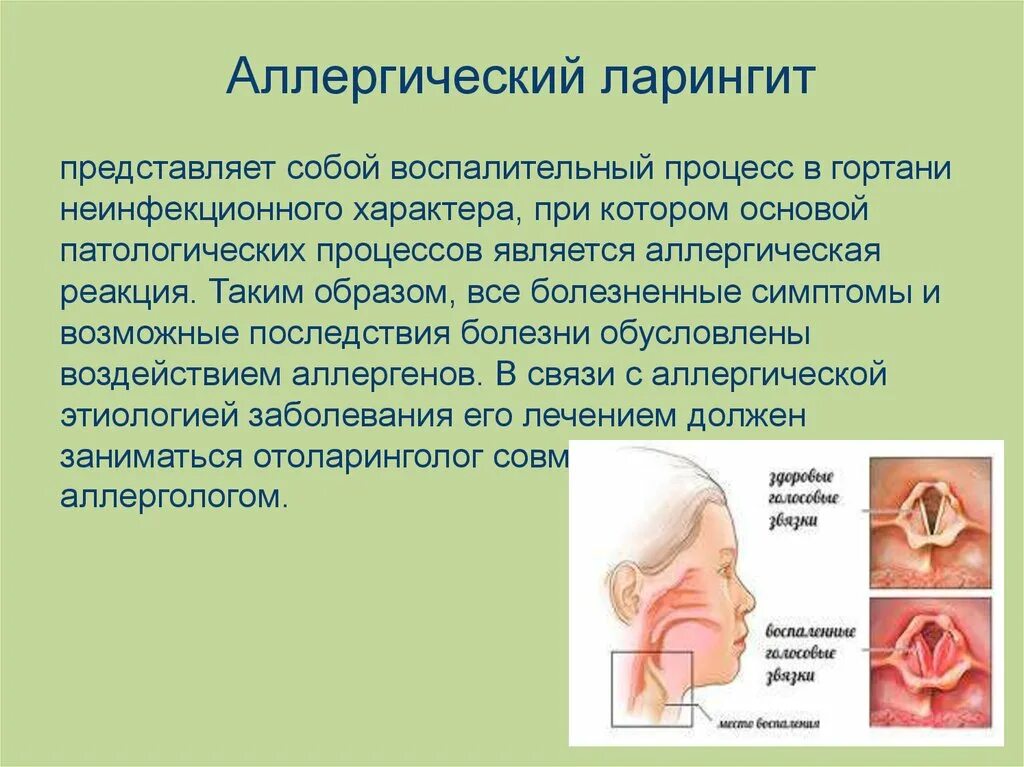 Подсвязочный ларингит. Признаки острого ларингита.