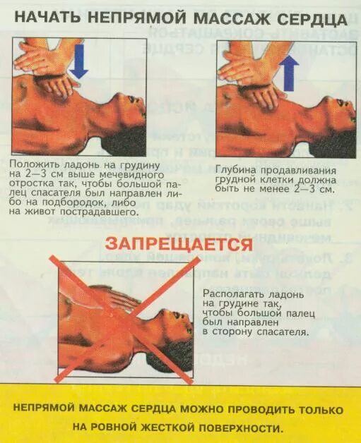 Прямой открытый массаж сердца. Прямой массаж сердца сколько. Частота нажатия на грудную клетку при непрямом массаже. При проведении непрямого массажа сердца. Частота нажатий на грудную клетку при непрямом массаже сердца.