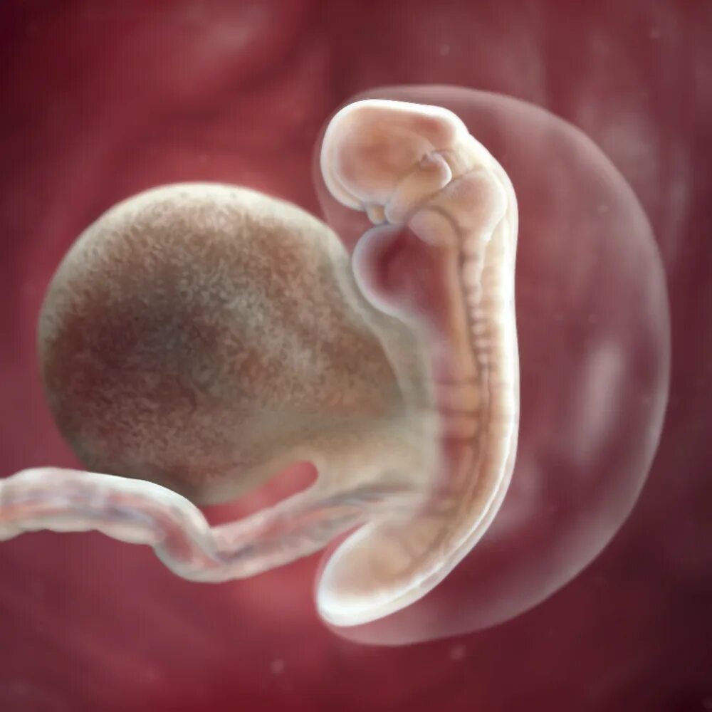 Зародышюш на 6 недели беременности. Эмбрион на 5 неделе беременности. Плод на 4-5 неделе беременности. 5 акушерских недель 5 дней