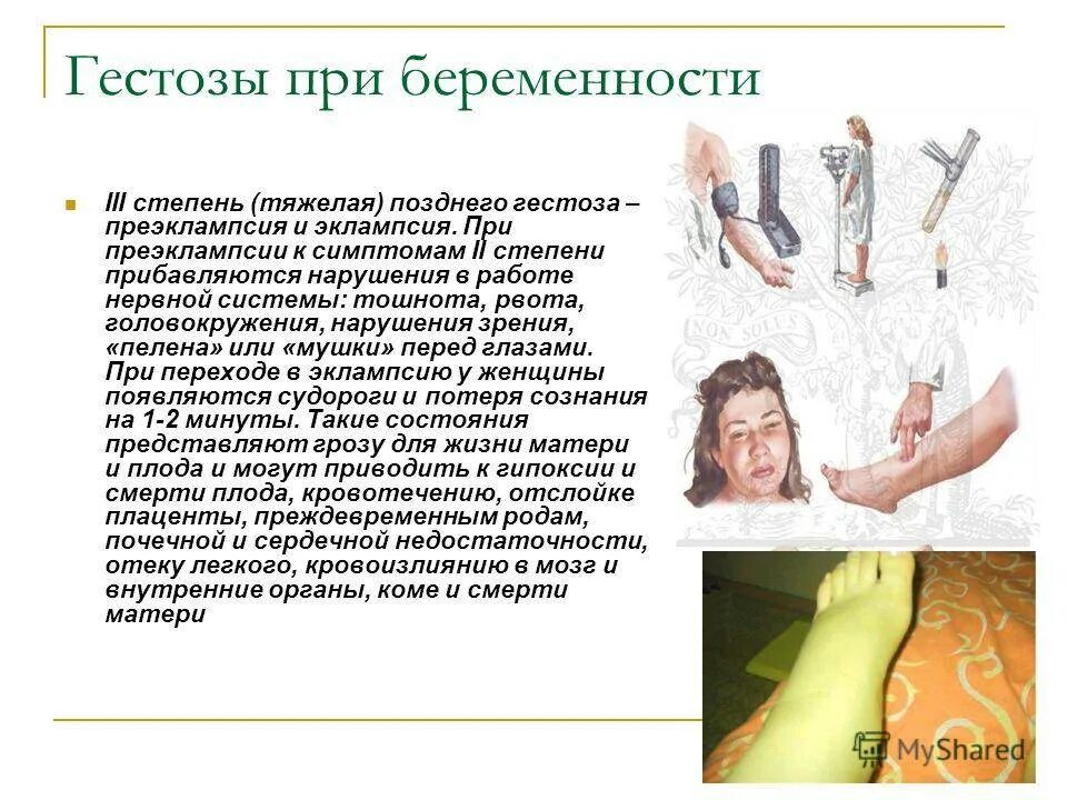 Токсикоз отзывы