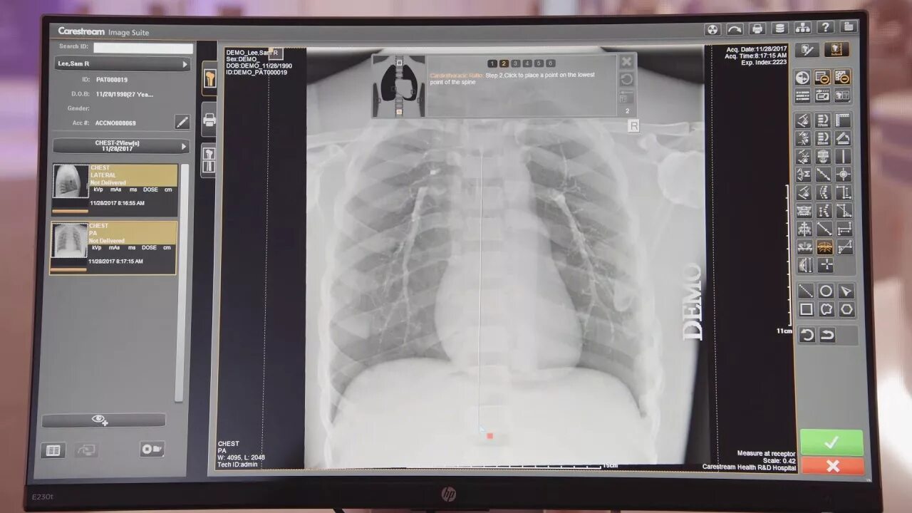 Xray программа. Siger digital x-ray imaging system. kodak carestream digital xray. carestream medical x-ray processor. xray detector.