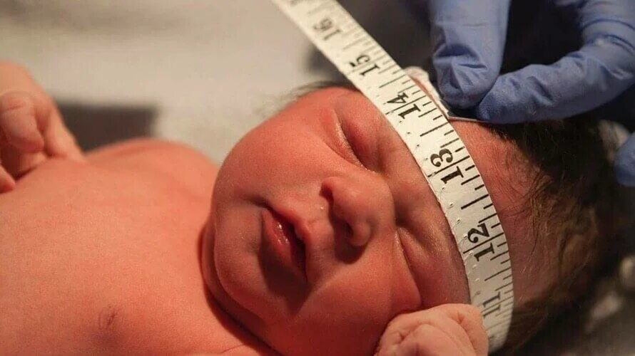 Гипоксия у новорожденного последствия. Кислородное голодание у новорожденного. Гипоксия у новорожденных. Гипоксия у новорожденного последствия. Что такое гипоксия у новорожденного ребенка.