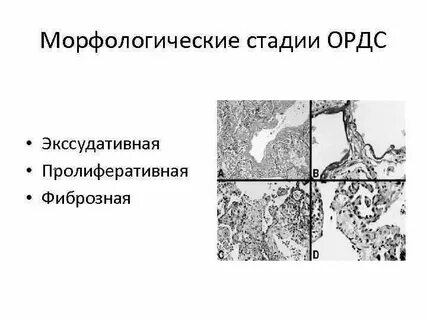 Морфологическая степень