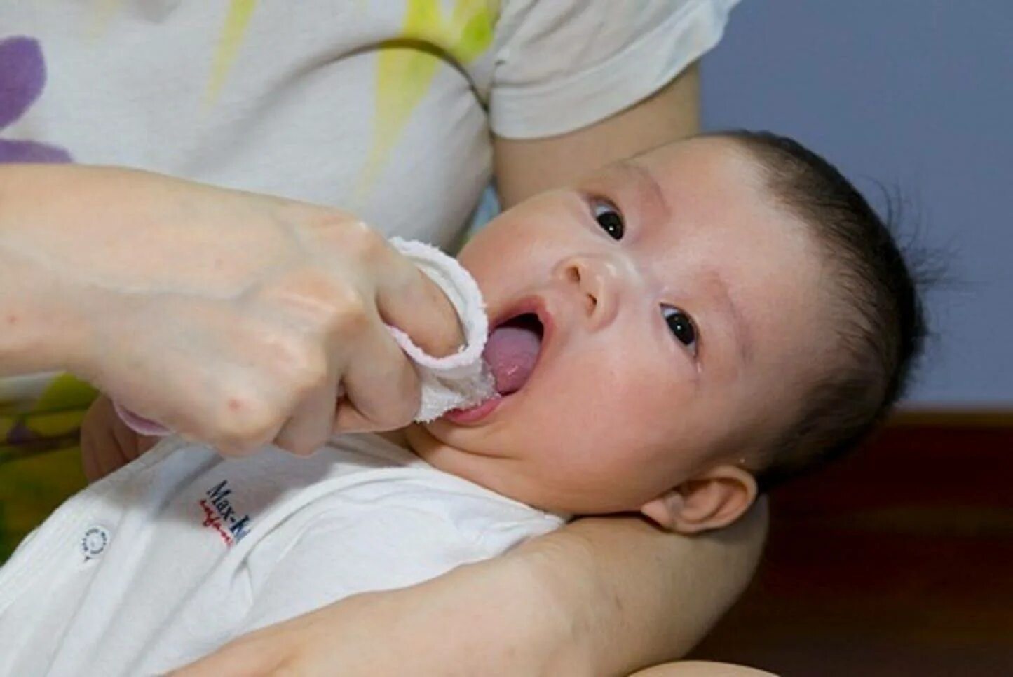Во рту малыша температура. Псевдомембранозный кандидозный стоматит. Полость рта у новорожденного грудничка. Стоматит уноврожденых.