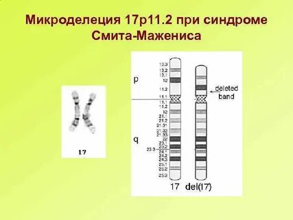 Хромосомный риск
