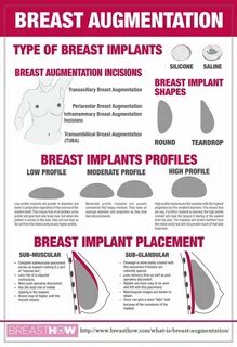 "boob job" The advanced guide explaining what is breast implants,...