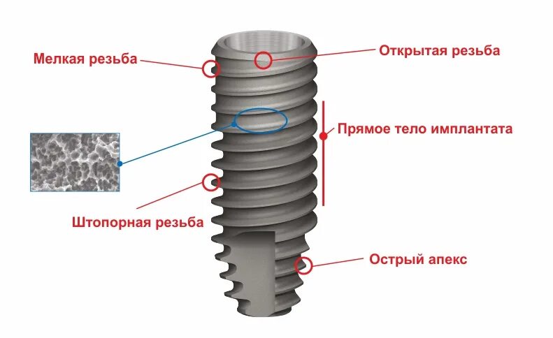 Имплантаты а2. Премиум импланты. Имплант дентиум. Имплантаты а2. Имплантаты а2.