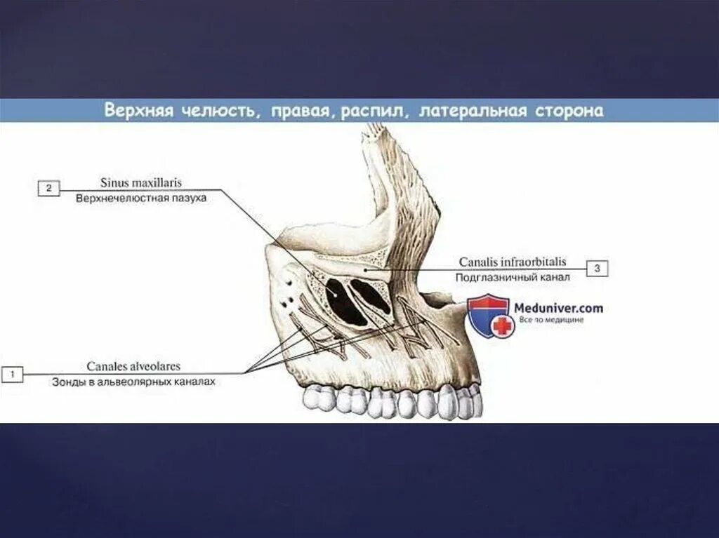 Костная основа полости рта. Альвеолярный отросток верхнечелюстной кости. Носовая поверхность тела верхней челюсти. Анатомические структуры верхней челюсти. Верхняя челюсть анатомия носовая поверхность.