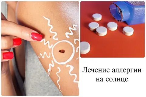 Аллергическая реакция на лекарства