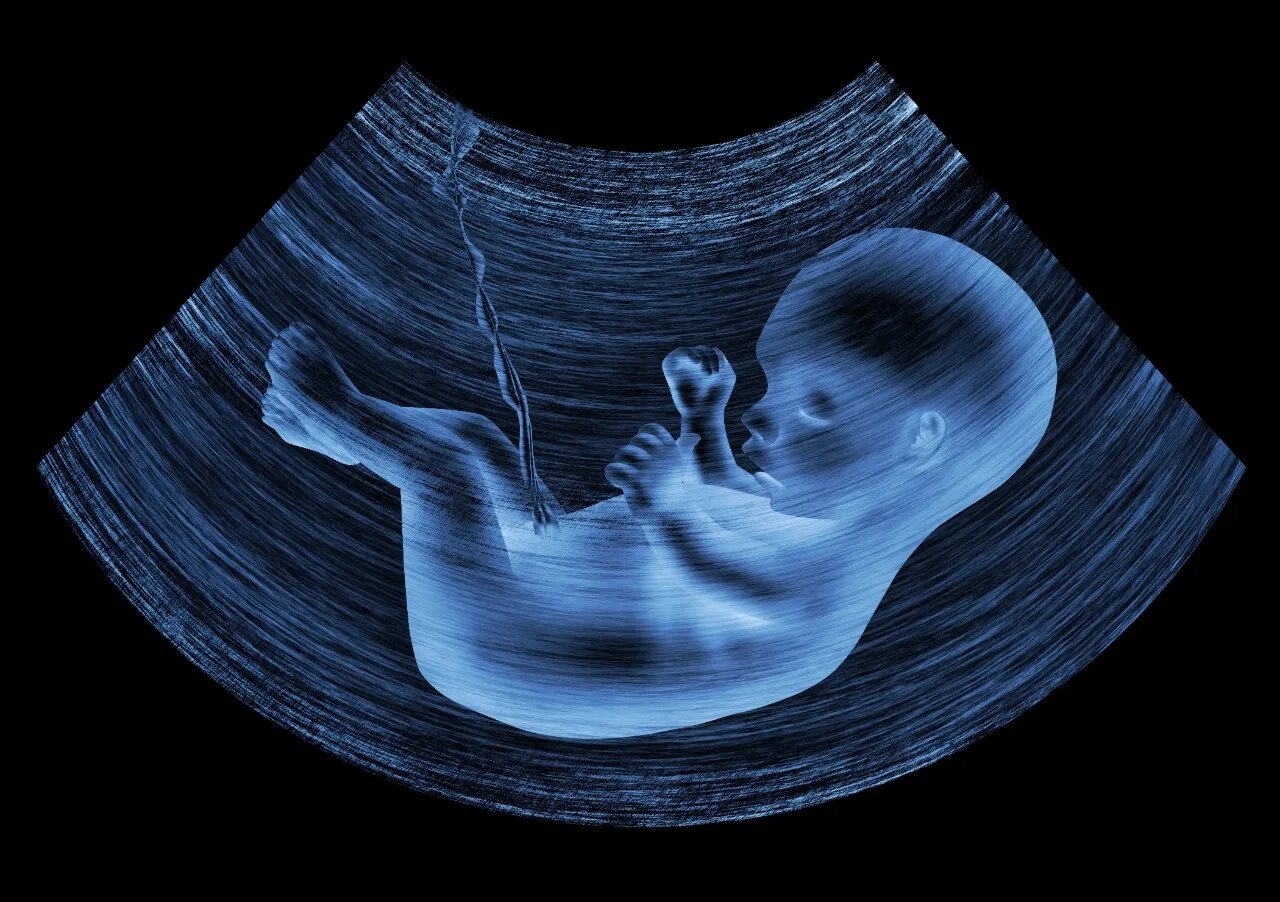 PPT - In the womb PowerPoint Presentation, free download - ID:289763