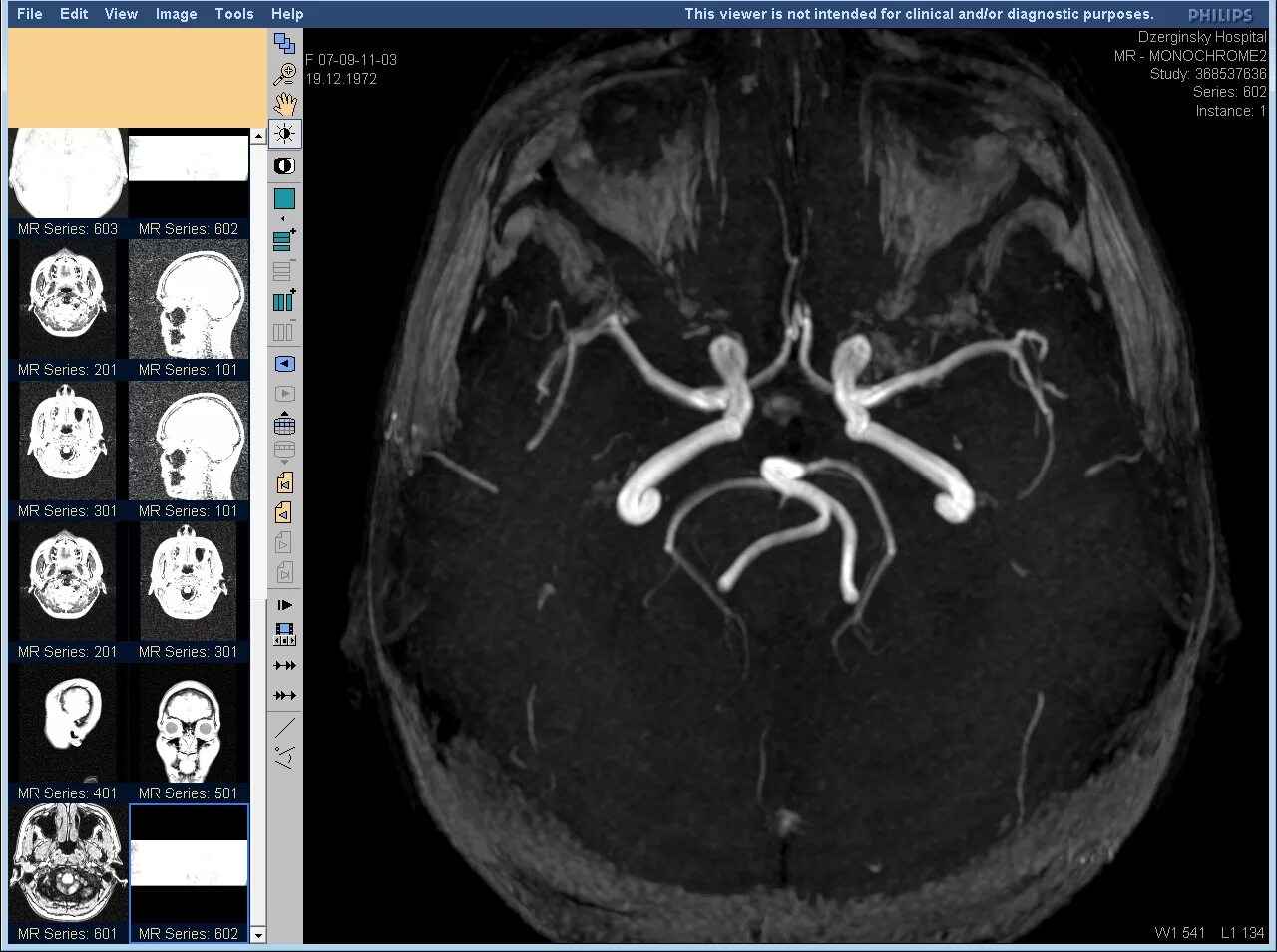 Сосуды головного мозга норма. Магнитно-резонансная ангиография сосудов головного мозга. Кт (компьютерная томография) сосудов головного мозга. Кт ангиография сосудов головного мозга. Мрт ангиография артерий головного мозга.