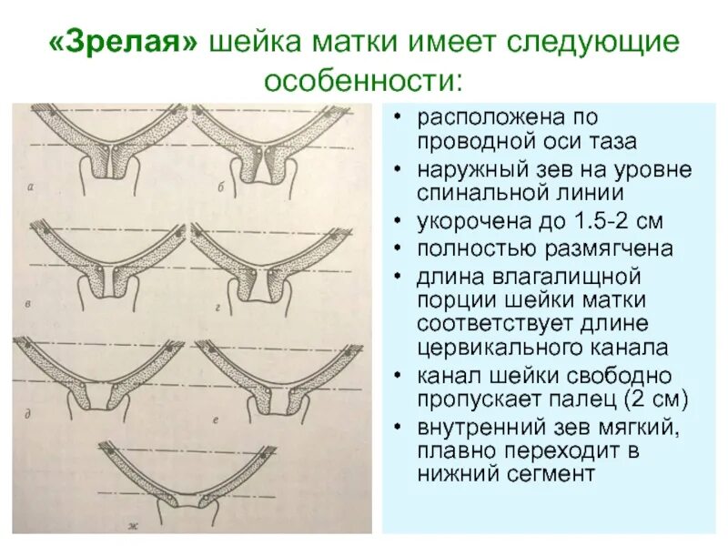 Зев т образный
