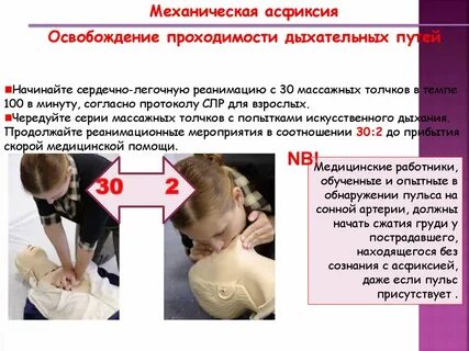 Сердечная асфиксия
