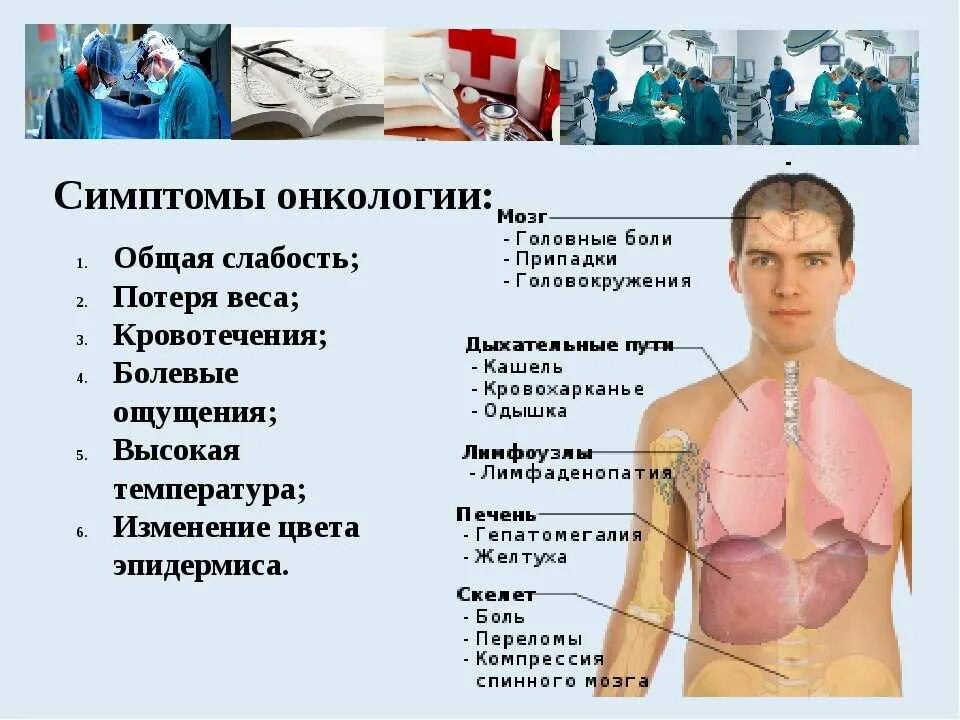 Почему бывает рак. Общие симптомы онкологии. Симптомы онкологических заболеваний. Основные симптомы онкологии. Симптомы раковых заболеваний.