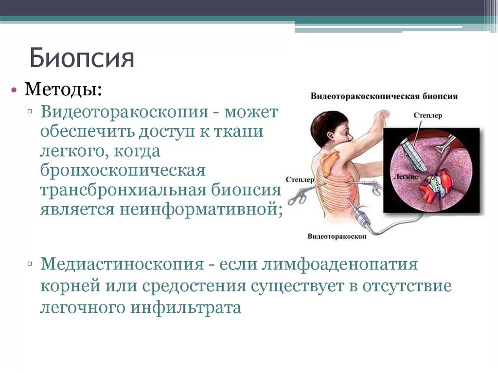 Трансбронхиальная пункционная биопсия. Методика проведения биопсии легкого. Биопсия легких как проводится