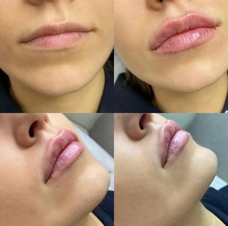 lips lips lips 3