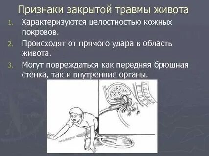Признаки закрытой травмы живота