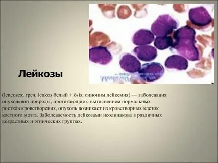 Костный лейкоз
