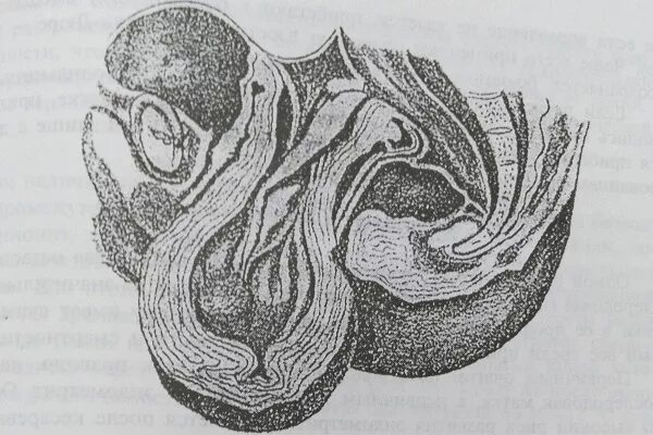 Половая щель девушки. Приколы про паркет. Верблюжья губ в леггинсах. Леотард камель. Половая щель девушки.